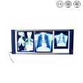 Ysx1706 Hospital X-ray Film Viewer